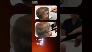 Harris Hair Transplant UK