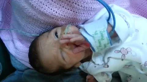skyla the premature baby 29 weeks