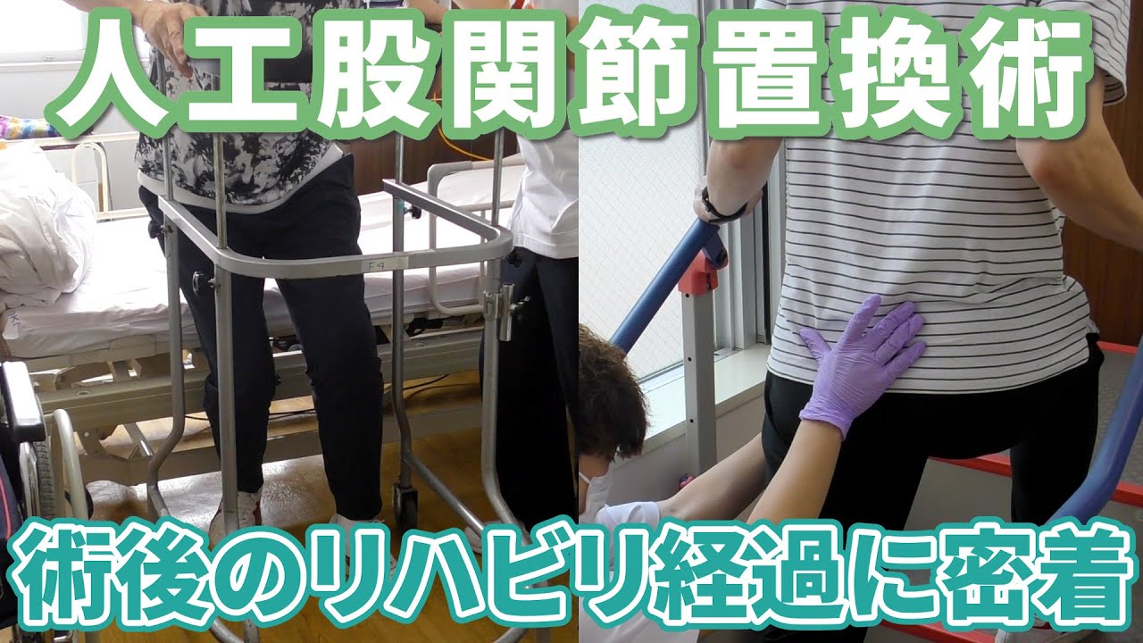 【新座志木中央総合病院】 人工股関節置換術 術後経過に密着