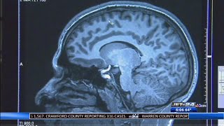 Brain aneurysm survivor discusses process of recovering