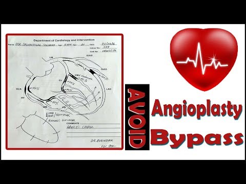 How to avoid angioplasty or bypass surgery,my experience /winter special pickle