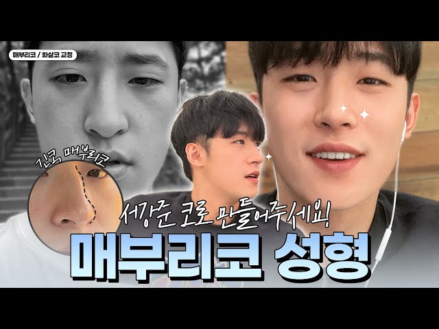 [VLOG] 서강준처럼 매끈한 코를 갖고 싶어요! #매부리코성형 #코끝성형