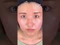 【二重整形/鼻整形】垢抜けた美人になりたい #shorts