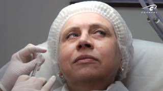 Контурная пластика обучение. Выбор техники коррекции носогубной складки. Контурная пластика обучение. Выбор техники коррекции носогубной складки.