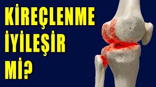Diz Kireçlenmesi ve Kıkırdak Hasarı: Bilimsel Olarak Ne Yapılmalı?