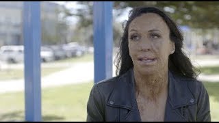 Turia Pitt On Having A Positive Mindset