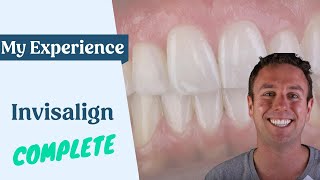 My Invisalign Experience Part 6 - Finally complete!
