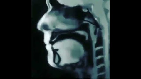 MRI of Tongue Movement while talking #shorts #MRI #medicalshorts