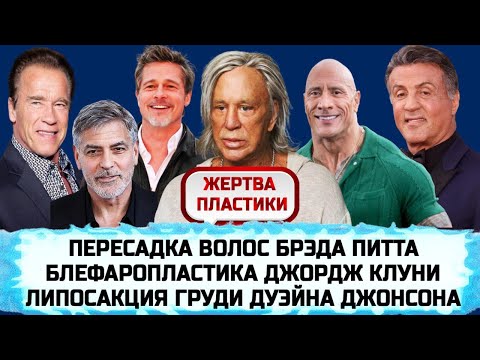 ЗНАМЕНИТЫЕ АКТЕРЫ ГОЛЛИВУДА, КОТОРЫЕ СДЕЛАЛИ ПЛАСТИКУ