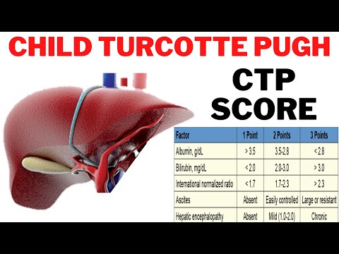 Child Turcotte Pugh (CTP Score) - What is the CTP score for cirrhosis of the liver? | 247nht