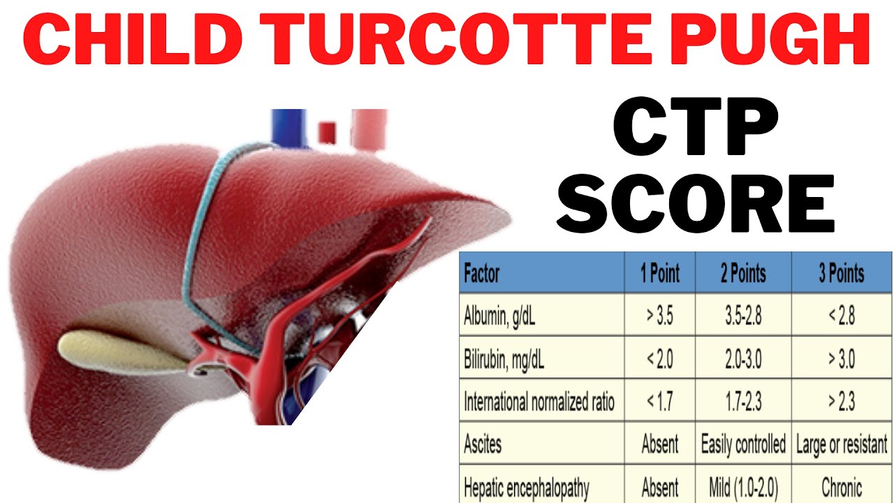 Child Turcotte Pugh CTP Score What Is The CTP Score For Cirrhosis Child Turcotte Pugh CTP Score What Is The CTP Score For Cirrhosis