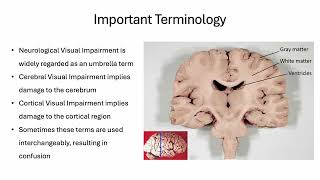 Unit 1 – Anatomy of NVI Powerpoint Presentation