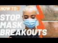How To Stop Face Mask Acne | Getting Rid Of Acne Mechanica | Stop Maskne Breakouts + Inflammation