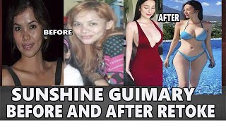 SUNSHINE GUIMARY BEFORE AND AFTER RETOKE!