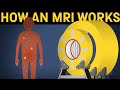 How does an mri machine work