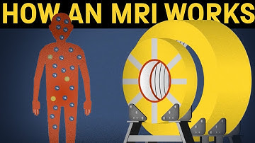 Hoe werkt een MRI-scanner?