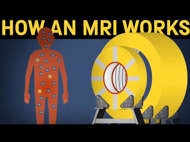 How does an MRI machine work? class=