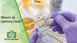 What is urinalysis?