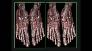 Cinematic Rendering: Principles, Pearls and Clinical Applications Part 1