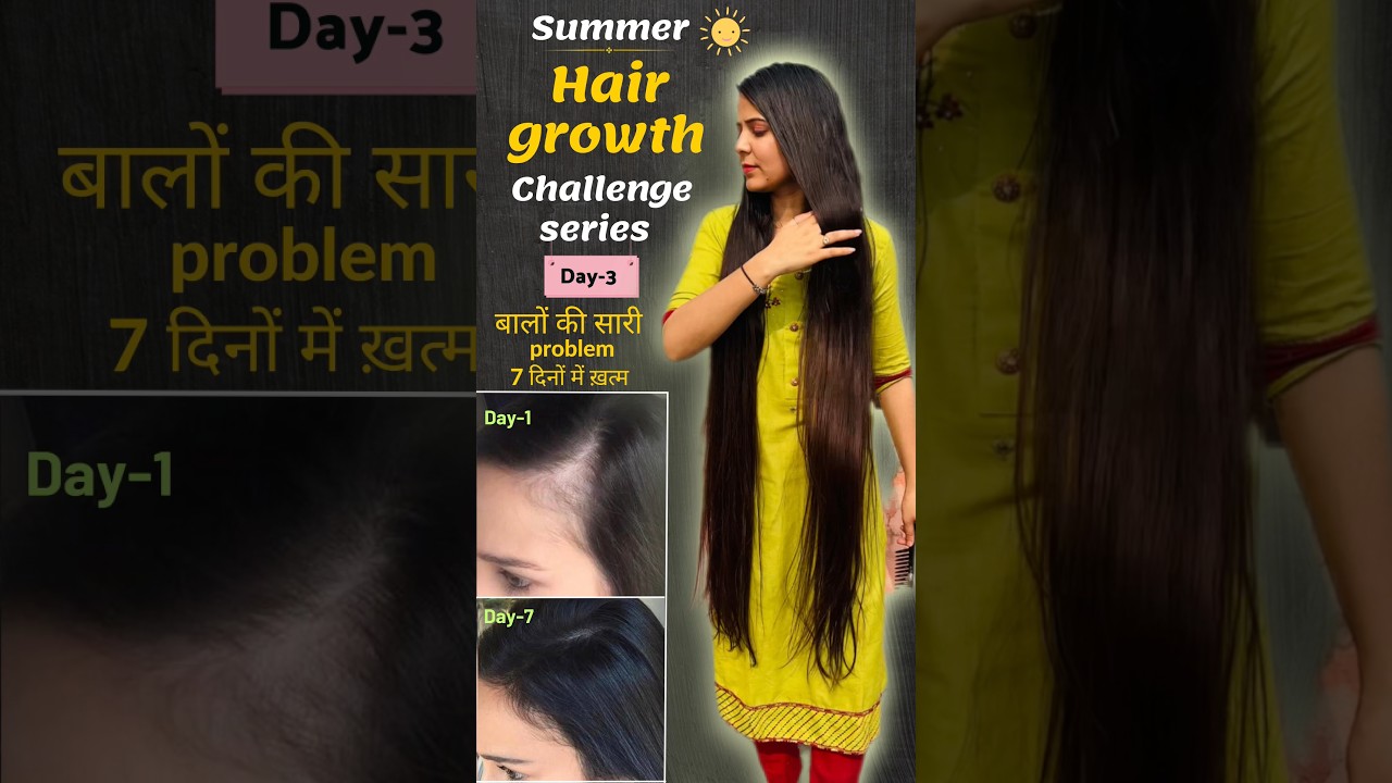 Day-3 | Summer Hair Growth Challenge Series | बालों Day-3 | Summer Hair Growth Challenge Series | बालों