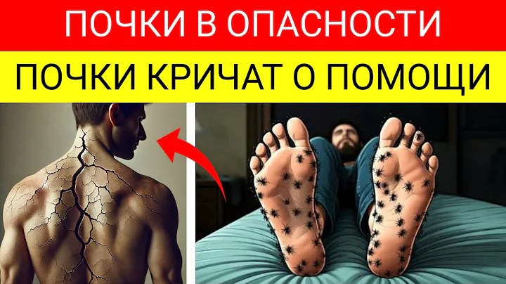 8 СТРАННЫХ ПРИЗНАКОВ, ЧТО ВАШИ ПОЧКИ КРИЧАТ О ПОМОЩИ!