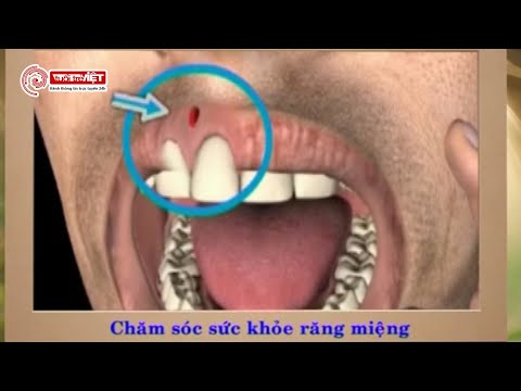 cách chăm sóc răng miệng hàng ngày tại Kemtrinam.vn