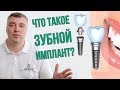 Нужно ли устанавливать зубной имплант? (Школа здоровых зубов)