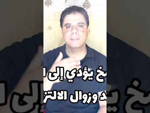فسخ العقد فى القانون المدنى المصرى