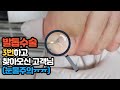 [대구내성발톱]발톱수술 3번한 고객님 마침내 통증에서 해방 ㅠㅠ(눈물주의) Removal Ingrown toenail WITHOUT PAIN