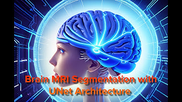 Brain MRI Segmentation Using U Net Architecture
