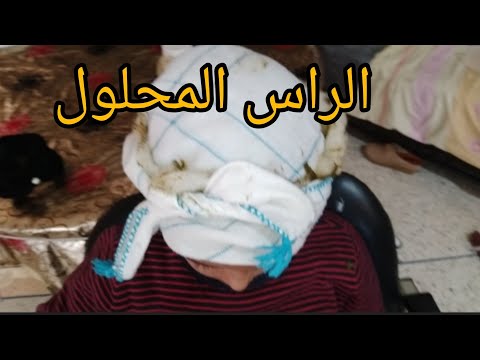 الرأس المحلول الرأس الكبير بالصوفة والحناء ربط الرأس عند الأطفال