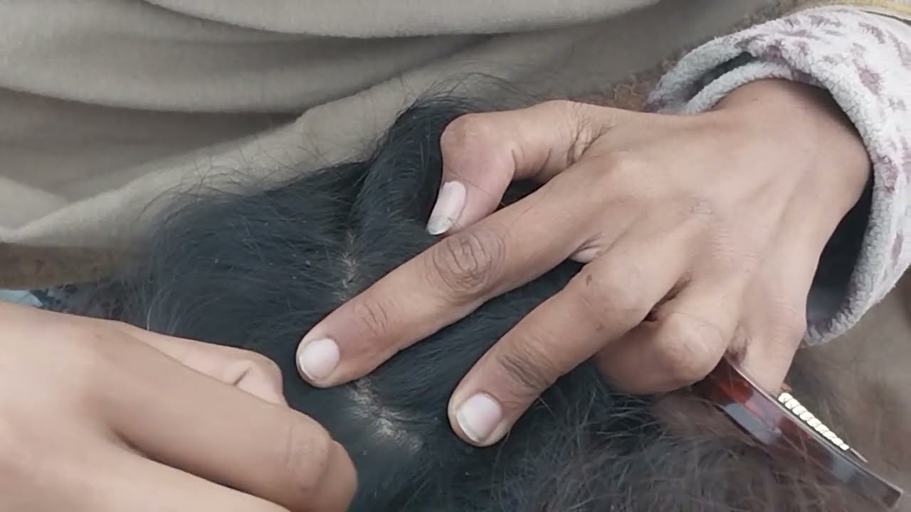 #nitpicking #asmr #licepicking  with sound video 63 #carikutu #piolho