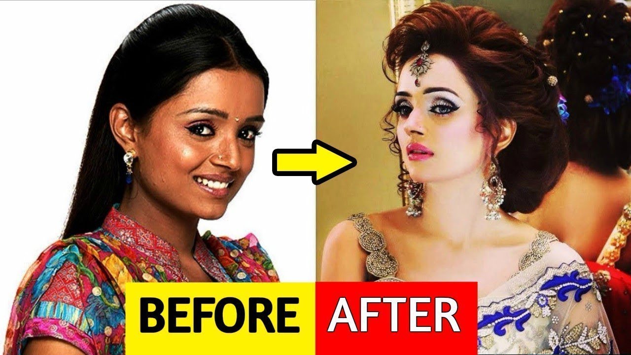 Top 10 Plastic Surgery Of Popular TV Actress Before And After Photos Of Plastic Surgery