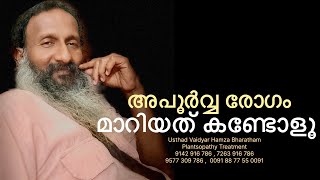 See how a rare disease has been cured by Usthad Vaidyar Hamza BharathamPlantsopathy Treatment