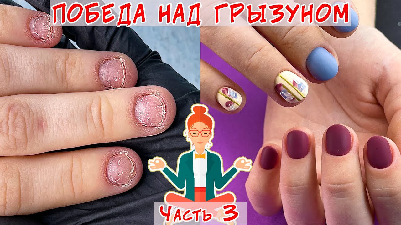 Восстановление обкусанных ногтей / Часть 3 / Ремонт трещины на ногте ...