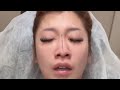 Beautiful Asian Girl Non Stop Sneezing Beautiful Asian Girl Non Stop Sneezing