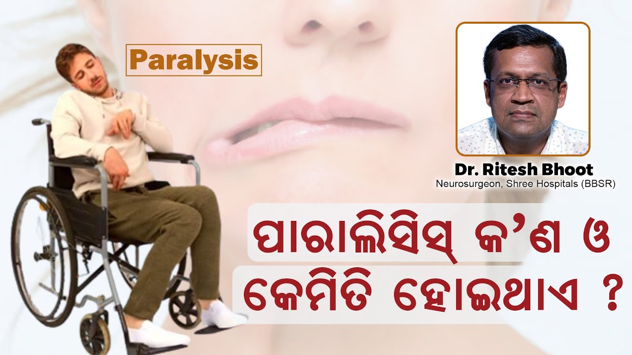 କେମିତି ହୋଇଥାଏ ପାରାଲିସିସ ? What is Paralysis? Know about it | Dr Ritesh Bhoot