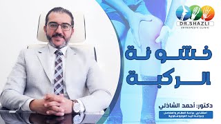 خشونة الركبة  | دكتور أحمد الشاذلي - إستشاري جراحة العظام والمفاصل