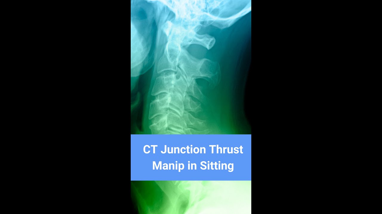 Cervicothoracic Junctional Thrust Manipulation in Sitting