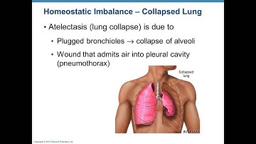 Chapter 22- Respiratory 2 - Gas Exchange and Lung Compliance