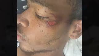 Duncanville police facing questions after arrest left 21-year-old man hospitalized