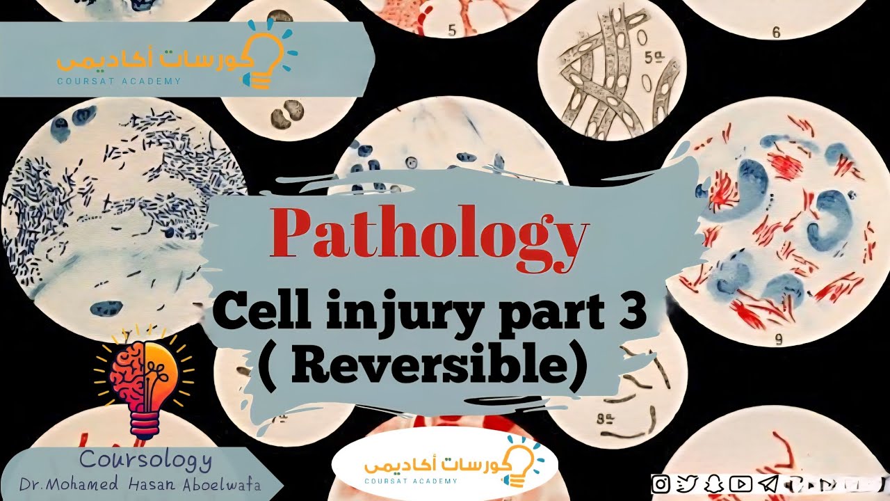 Reversible Cell injury part 3 (Cloudy swelling & Hydropic degeneration &Fat degeneration)