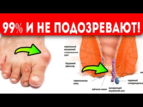 И лечит, и калечит! Никто не ожидал ТАКОГО от болгарского перца!