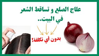 ماء البصل لعلاج الصلع و تساقط الشعر: الحقيقة الكاملة