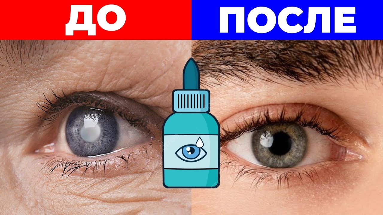 5 ЛУЧШИХ СРЕДСТВА ОТ КАТАРАКТЫ! ЕШЬТЕ ЭТО ЗРЕНИЕ БУДЕТ 100%зрение Катаракта