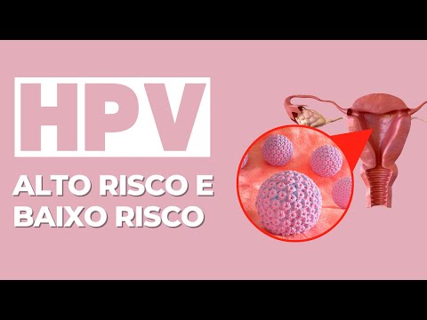 Vídeo: Os testes de alto risco devem ser eliminados?