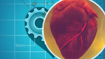 Myocardial Deformation