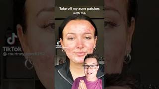😨THE TRUTH ABOUT PIMPLE PATCHES  (What TikTok Doesnt Tell You) #shorts