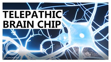 Elon Musk’s Brain Implant: How it Works