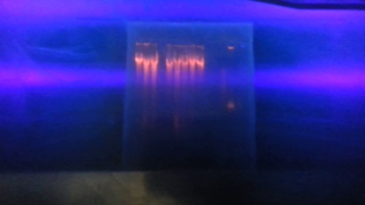 DNA, RNA and Protein band Illuminization under U-V light